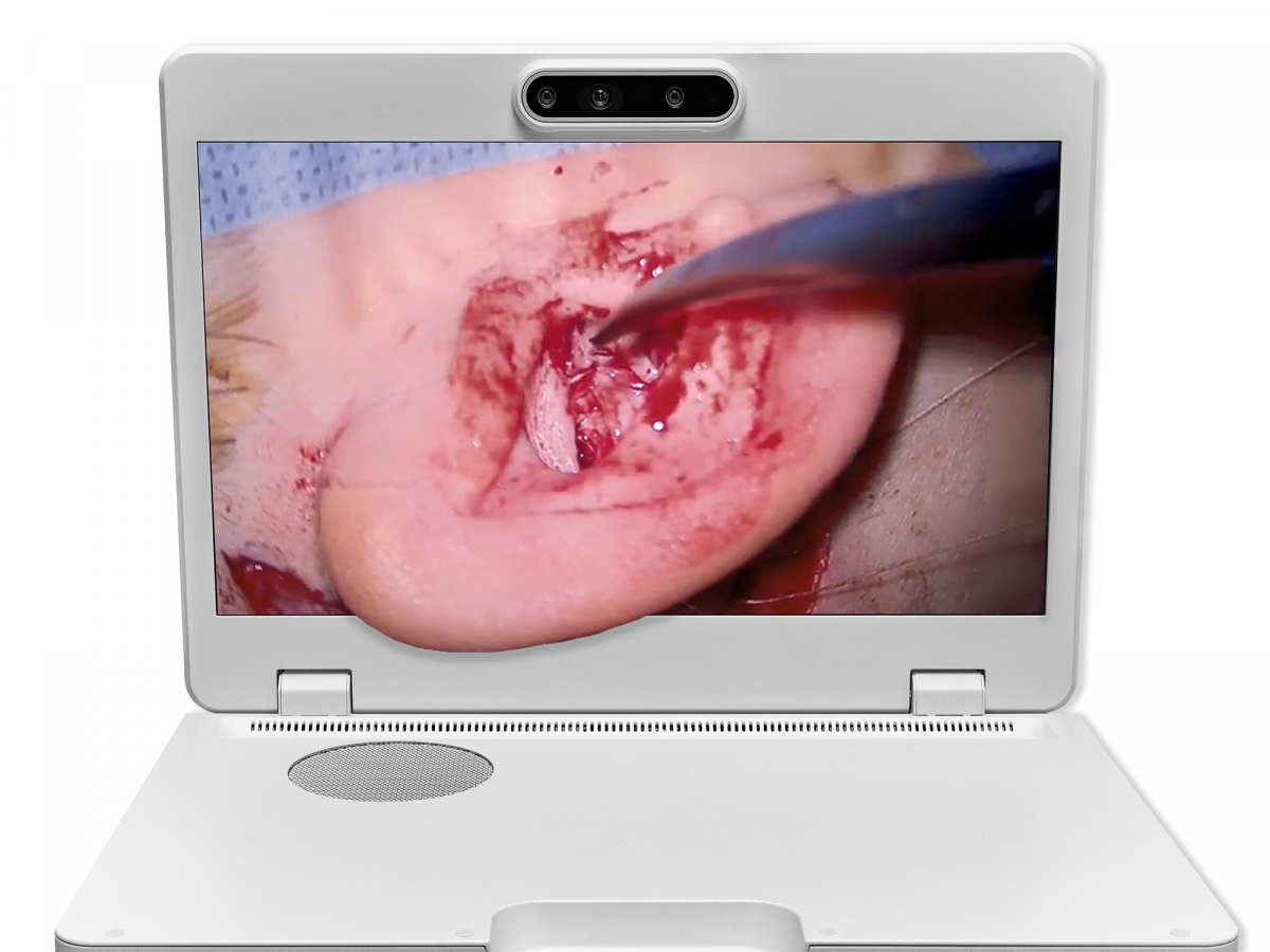 达擎之＂Heads-up 3D显微手术显示系统＂，整合4K裸眼3D显示及眼球追踪系统，具备快速追踪人眼移动位置功能，减轻医师长时间维持固定姿势的负担，让医师能有更宽广清晰的3D立体视野及更舒适的姿势来执行手术。